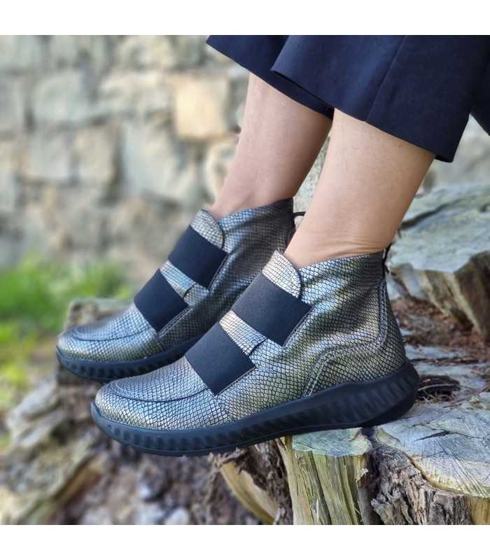 Modelo usando el botón Jarlen Albacore en un conjunto casual chic .